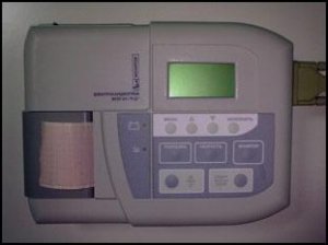 Аппарат для электрокардиографии (ЭКГ)